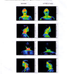 Thermography_2_2012