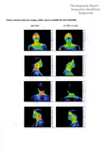 Thermography 2 2012 jpeg webp